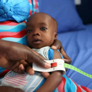 Malnutrition in Nigeria